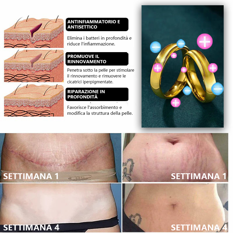 (š„Ultimo giorno di promozione ā Sconto dellā80% sul prezzo) DIYSTAR šAnello con Occhio di Gatto per Terapia Magnetica Linfatica