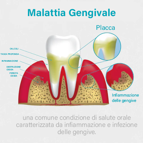 NESLEMY™ Gel Terapia per Gengive – Cura Professionale per la Salute delle Gengive e Prevenzione del Recedimento