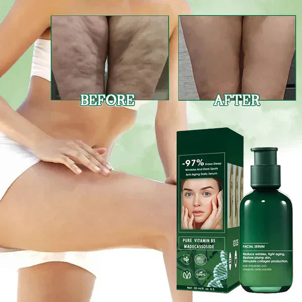๐ฅ๐ฉโโ๏ธLast Day Promotion ๐๐%๐๐
๐
- SkinFirming Rejuvenating Serum๐ฅ