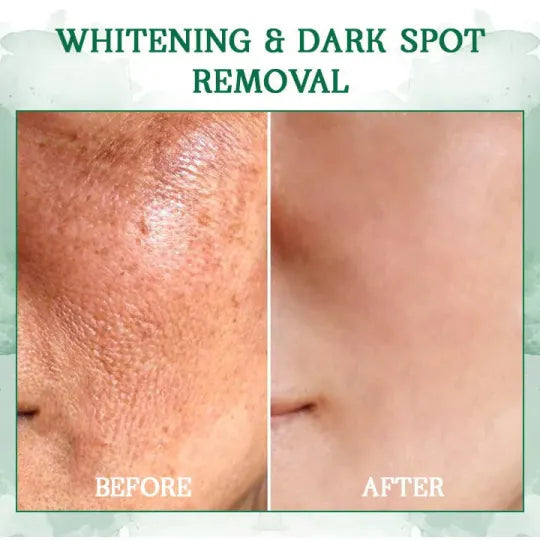 ๐ฅ๐ฉโโ๏ธLast Day Promotion ๐๐%๐๐
๐
- SkinFirming Rejuvenating Serum๐ฅ