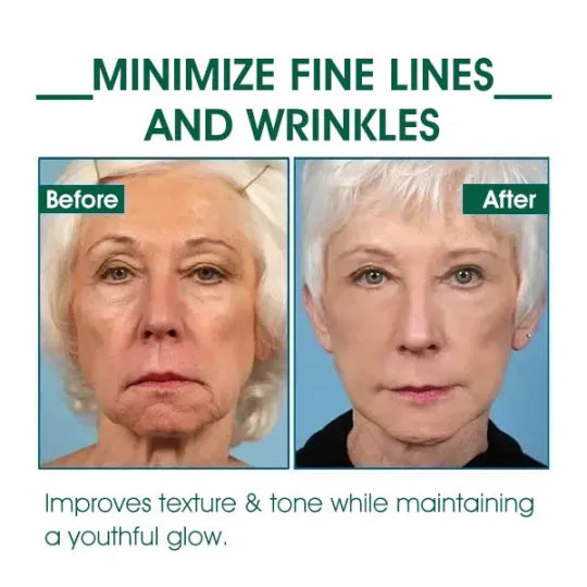 ๐ฅ๐ฉโโ๏ธLast Day Promotion ๐๐%๐๐
๐
- SkinFirming Rejuvenating Serum๐ฅ