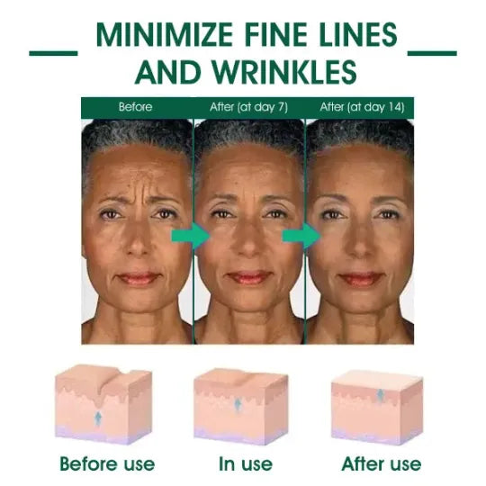๐ฅ๐ฉโโ๏ธLast Day Promotion ๐๐%๐๐
๐
- SkinFirming Rejuvenating Serum๐ฅ