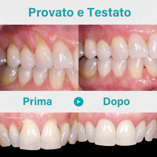NESLEMY™ Gel Terapia per Gengive – Cura Professionale per la Salute delle Gengive e Prevenzione del Recedimento