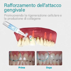 NESLEMY™ Gel Terapia per Gengive – Cura Professionale per la Salute delle Gengive e Prevenzione del Recedimento