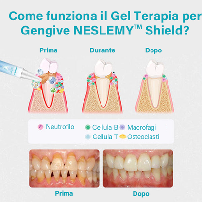 NESLEMY™ Gel Terapia per Gengive – Cura Professionale per la Salute delle Gengive e Prevenzione del Recedimento
