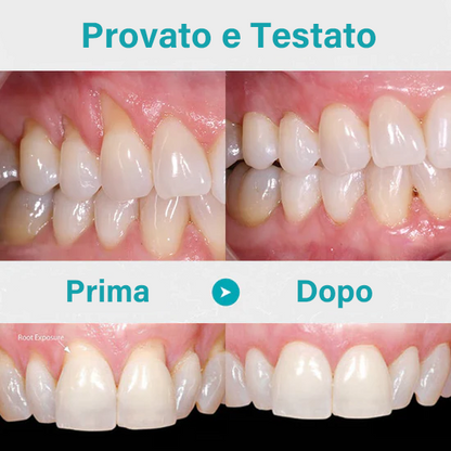NESLEMY™ Gel Terapia per Gengive – Cura Professionale per la Salute delle Gengive e Prevenzione del Recedimento